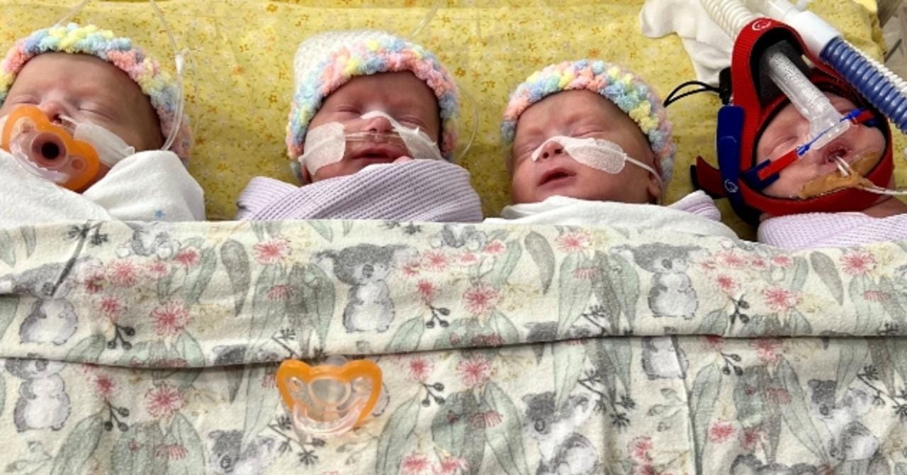 White as a ghost: Dad's first reaction to quadruple miracle | The Courier Mail White as a ghost: Dad's first reaction to quadruple miracle | The Courier Mail