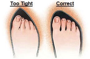 Too small shoes toe pain top