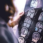 The Social Brain