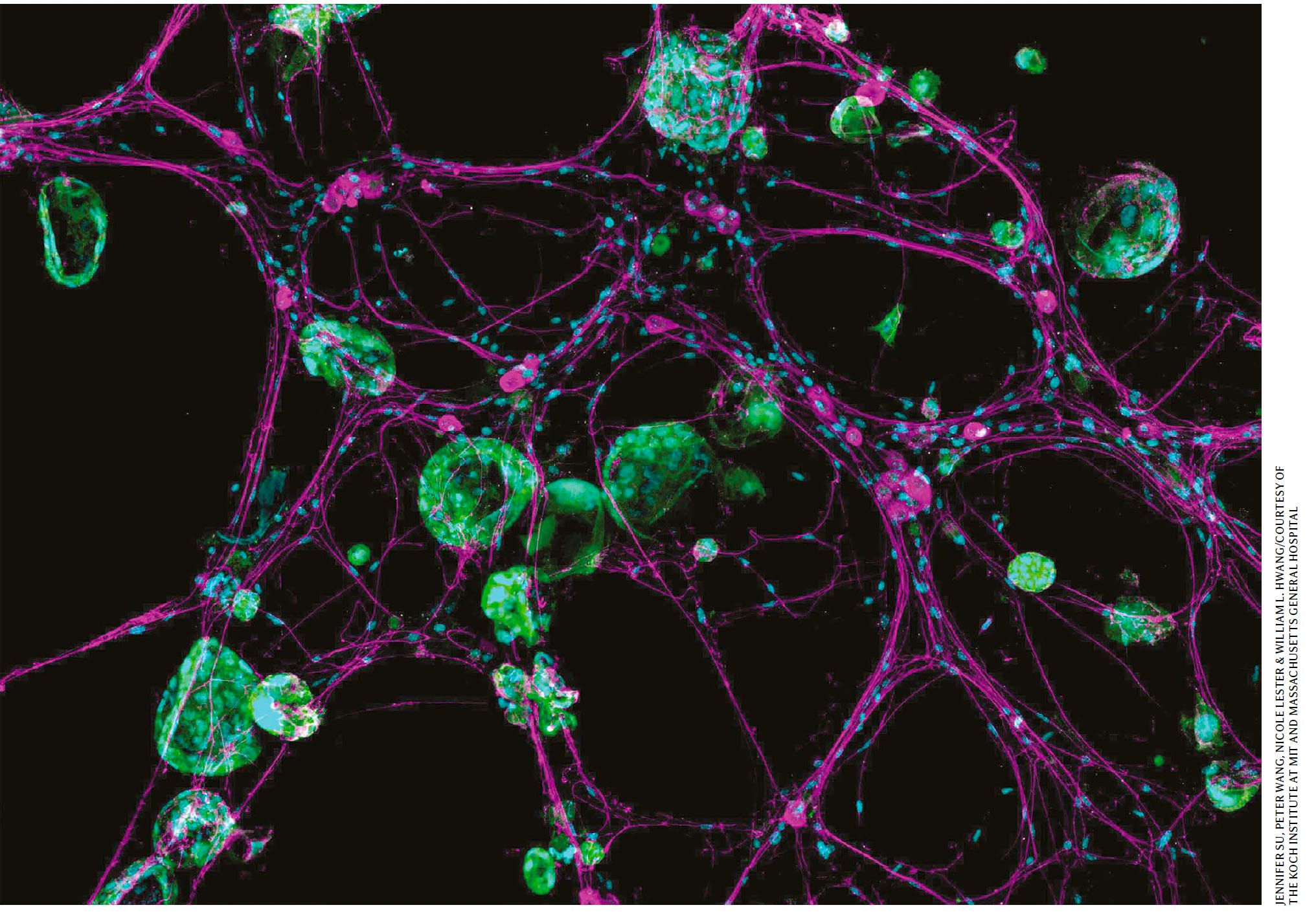 Cancer, the Master of Hijacking - by Eric Topol