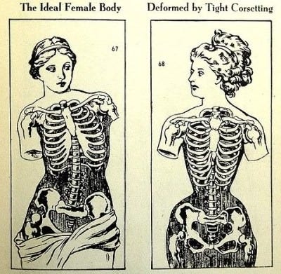 Venus de Milo vs Victorian corseted woman. *sigh* Not this again. Venus de Milo vs Victorian corseted woman. *sigh* Not this again.