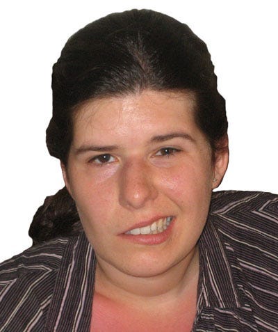 close up of woman with Bell’s palsy, including a drooping of the left side of her mouth.