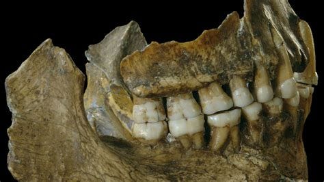 Prehistoric 'Aspirin' Found in Sick Neanderthal's Teeth | National ...