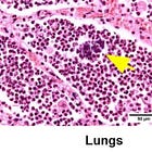 DEATH SHOT: Postmortem Study Of Vaccinated Man Reveals 'Viral RNA Found In Every Organ Of The Body'