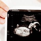 Pro-life group exposes late-term abortion industry with undercover video