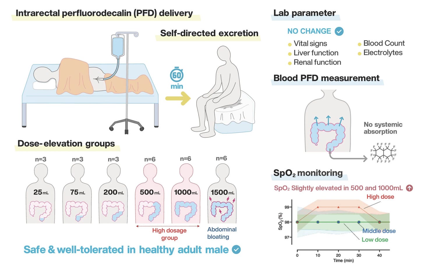 Visual abstract shows highlights of enteral ventilation concept developed by Takanori Takebe, MD, PhD, and colleagues