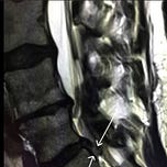Beyond Back Pain with Sarah Key