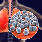 C-reactive protein to guide steroid use in severe community-acquired pneumonia