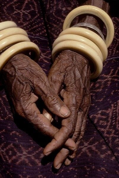 This may contain: an old woman's hands holding two yellow springs on her arm and the other hand