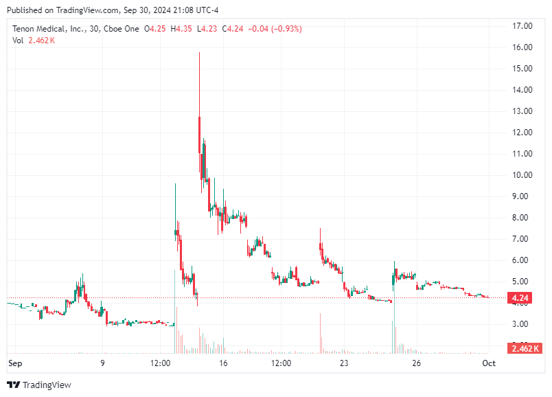 TradingView chart TradingView chart