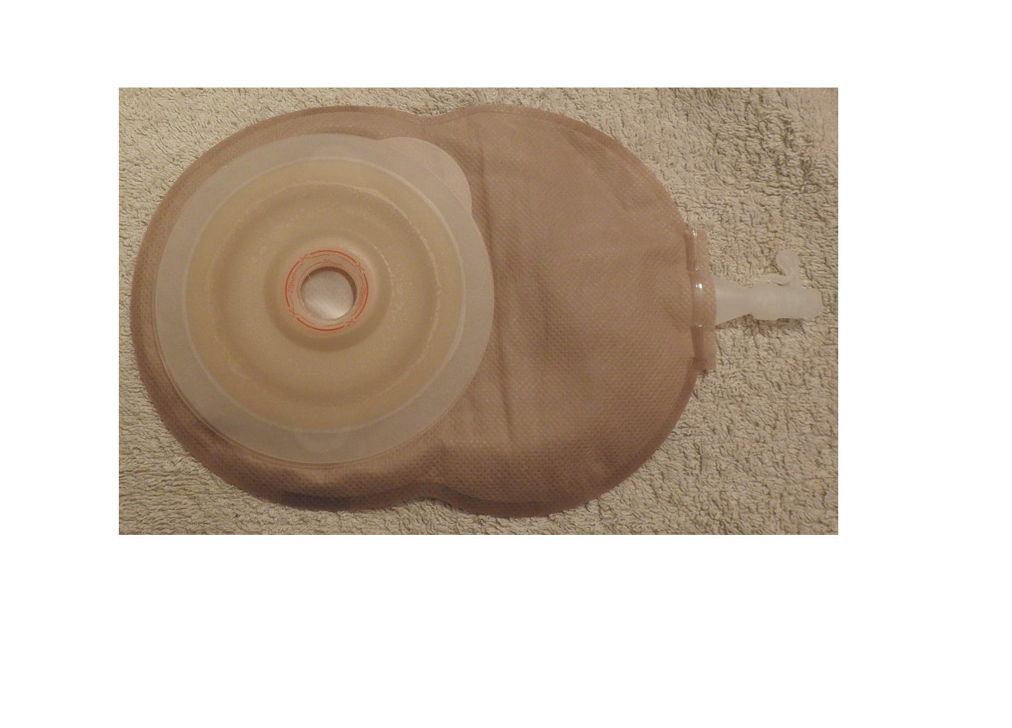 Photo of urostomy bag Photo of urostomy bag
