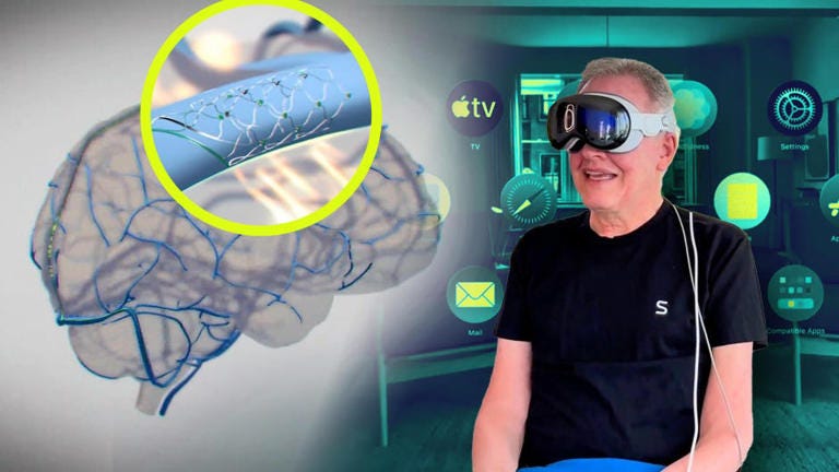 A brain implant device from Synchron is part of a partnership with Apple to allow brainwave control of some of its devices. Synchron
