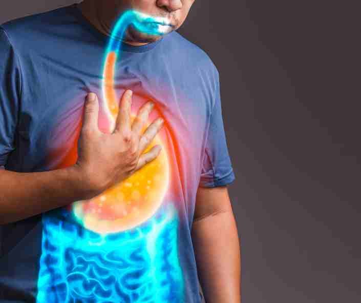 GERD VA Disability Rating