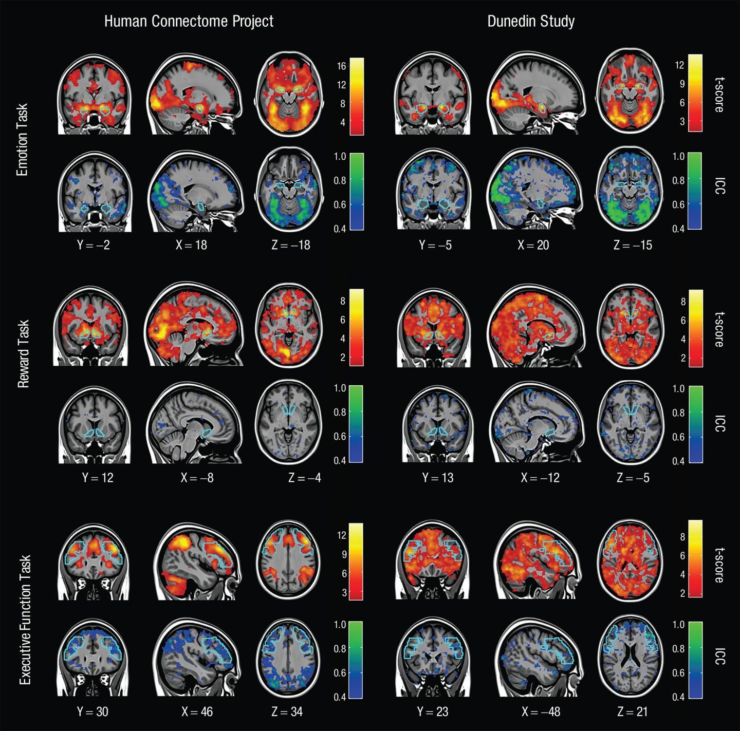 fMRI brain scans illustrate neural activity patterns during emotion, reward, and executive function tasks from two major human brain studies