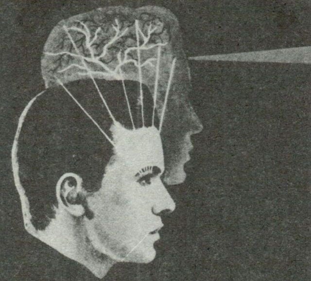 This may contain: a black and white photo of a man with a brain model on his head, in profile This may contain: a black and white photo of a man with a brain model on his head, in profile