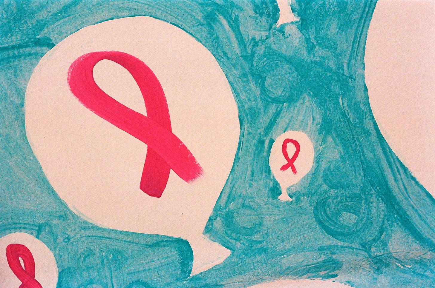Breast Cancer Breast Cancer