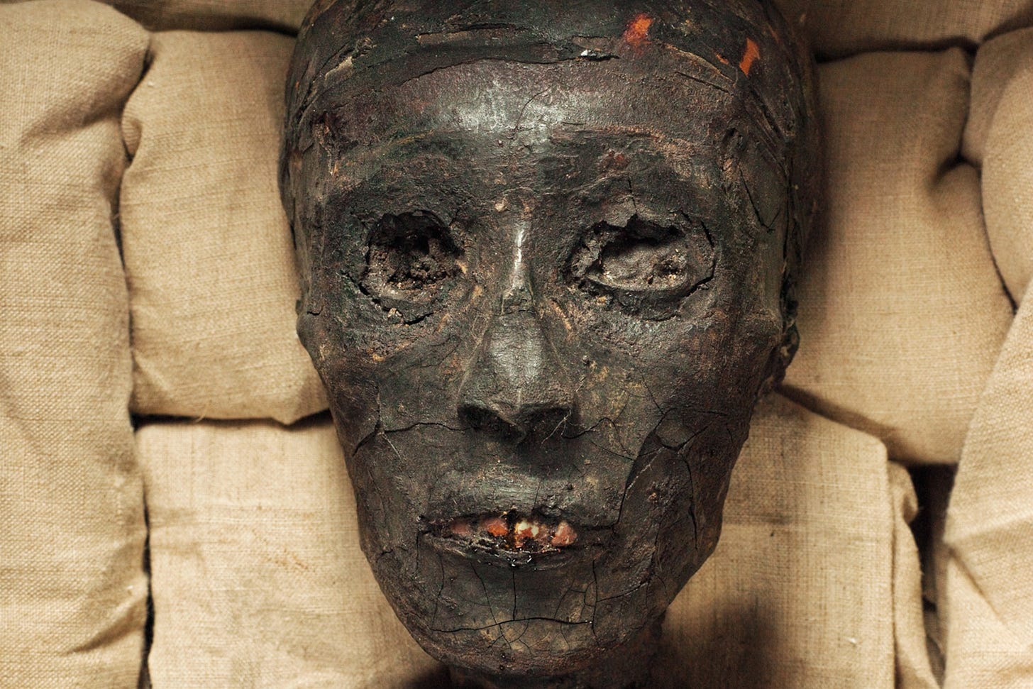 Mystery of King Tut's Death Solved? Maybe Not