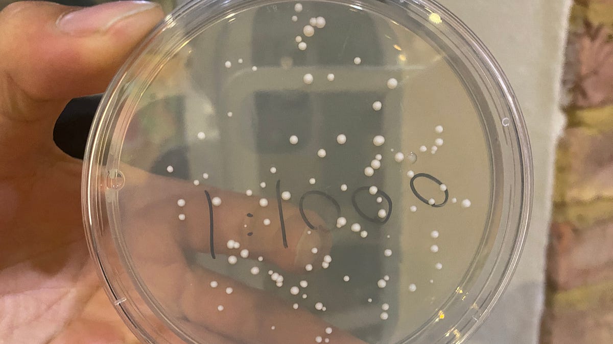 I Managed To Grow Countable Yeast Colonies 