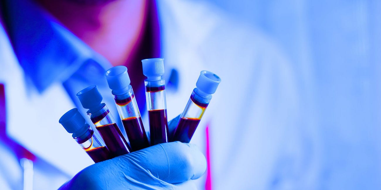 Moderna Jab mRNA Enters Blood, Stays for Weeks—We Were Told It Wouldn't: Journal 'ACS Nano'