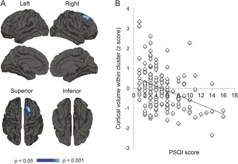 Poor sleep is associated cortical atrophy: A – spatial maps showing affected regions. B – Scatterplot showing reduced cortical volume with poor sleep quality (PSQI score). Wake up to pee