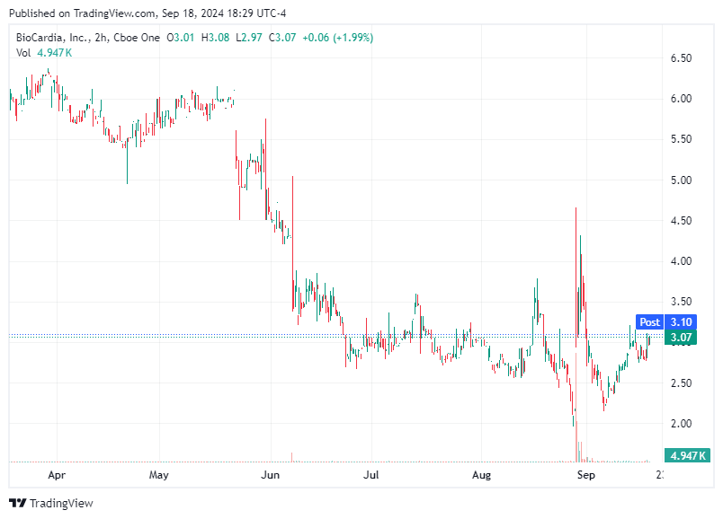 TradingView chart TradingView chart