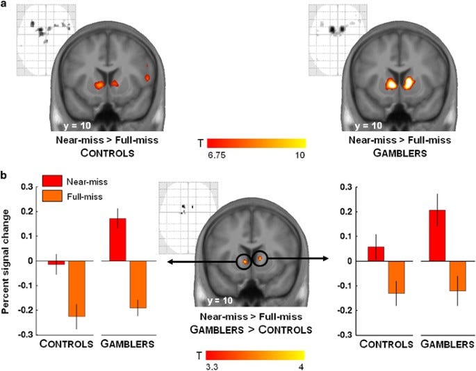 Amplified Striatal Responses to Near-Miss Outcomes in ...