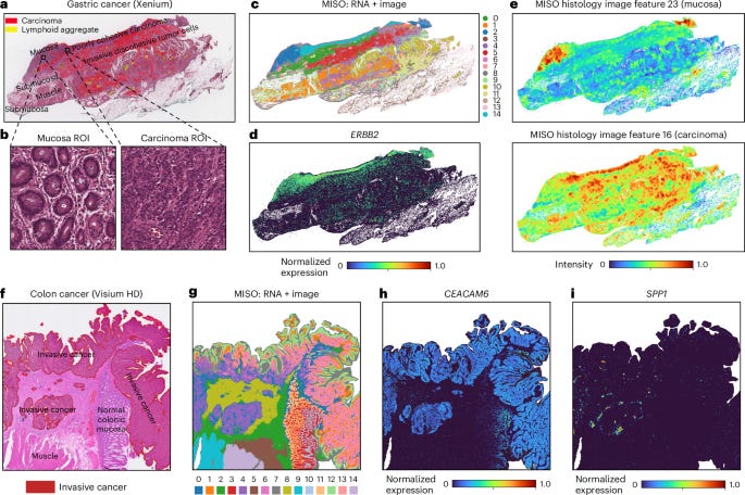 Resolving tissue complexity by multimodal spatial omics modeling with MISO | Nature Methods Resolving tissue complexity by multimodal spatial omics modeling with MISO | Nature Methods