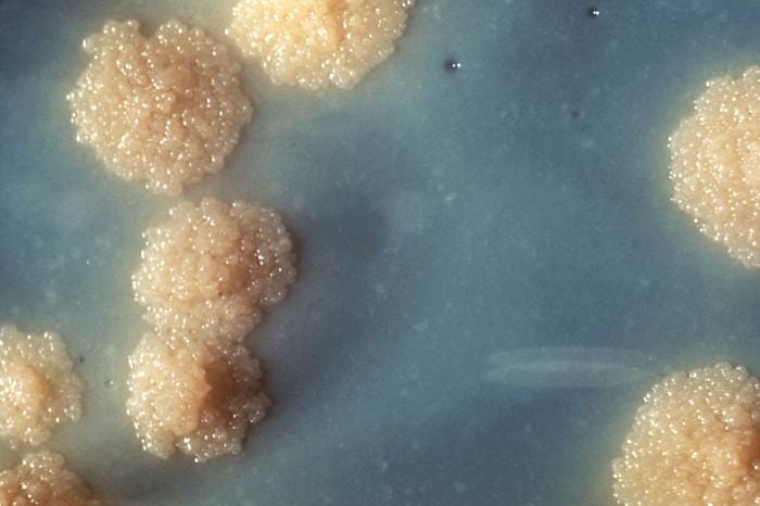A close-up of a Mycobacterium tuberculosis culture revealing this organism’s colonial morphology. Note the colorless rough surface, which are typical morphologic characteristics seen in Mycobacterium tuberculosis colonial growth.