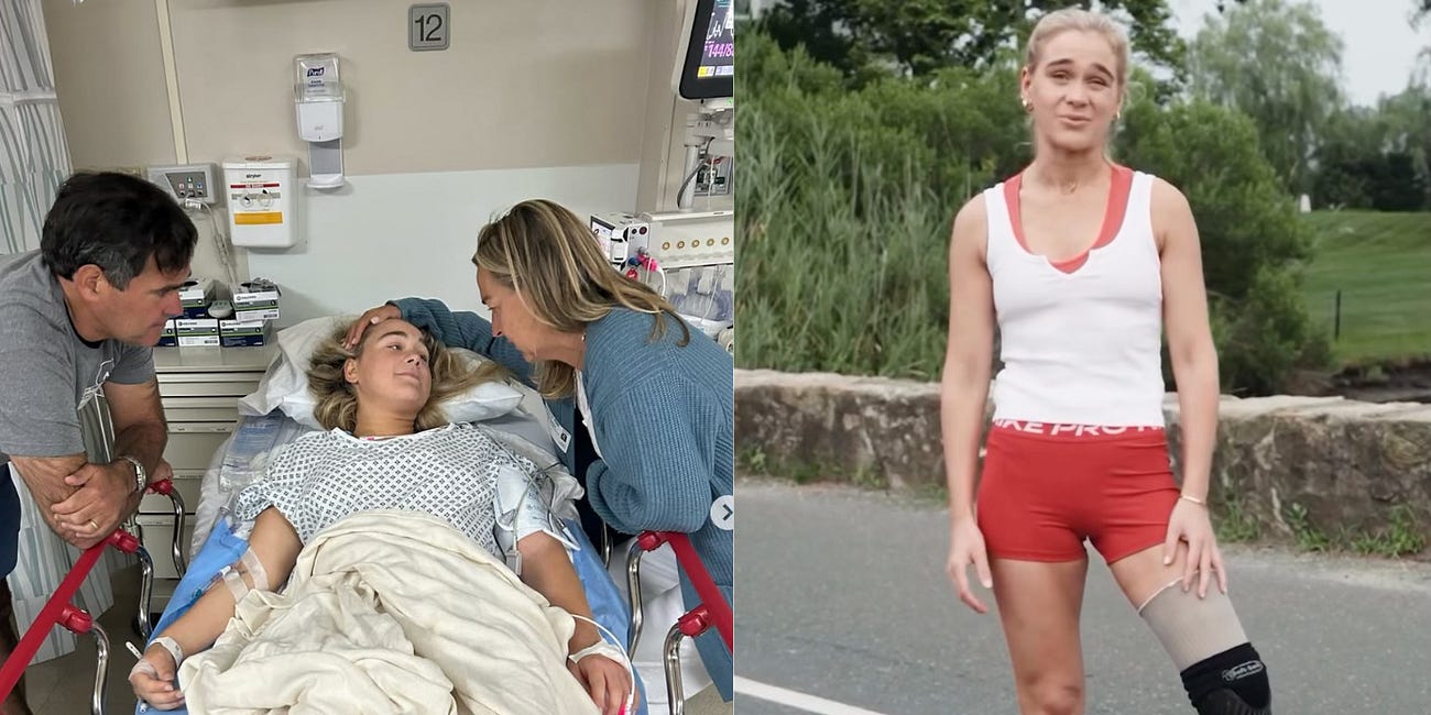 I lost my leg in a shark attack. This is how I fought back.