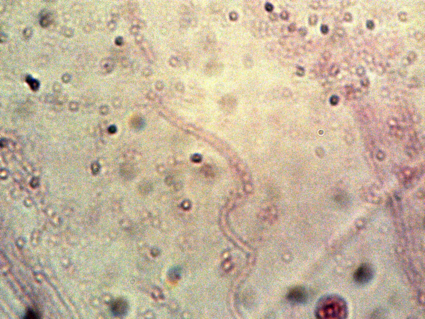 gram stain of cbd