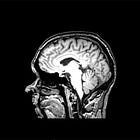 The Dopaminergic System: The Complete Neuroscience Breakdown