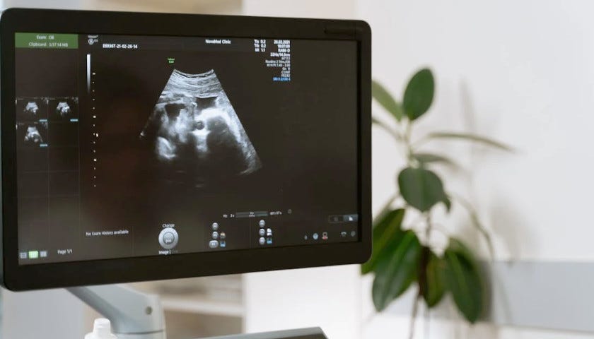 ultra sound