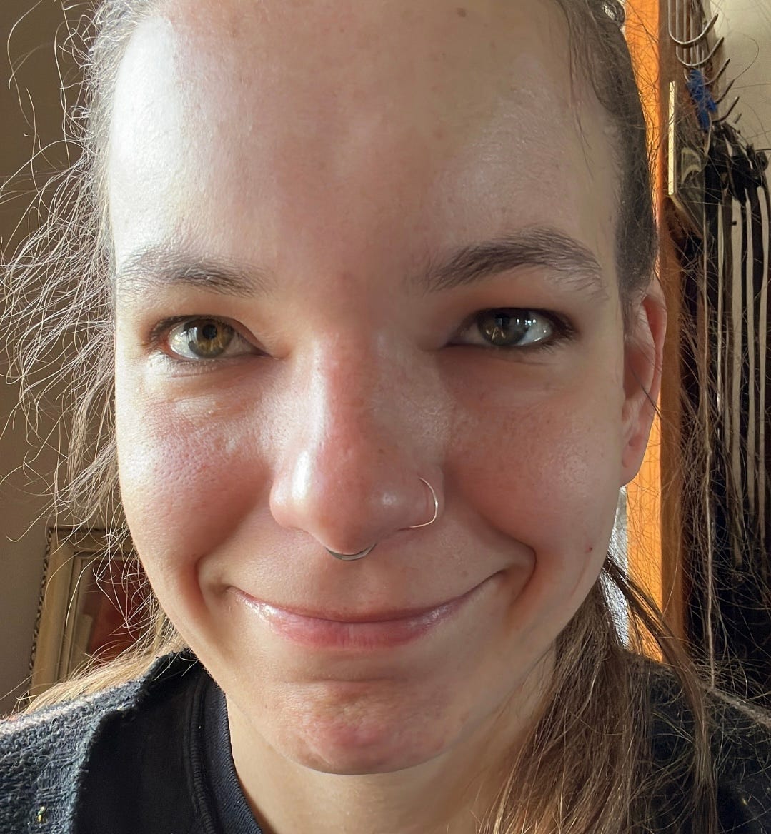 Beekeeper with swollen head due to bee sting