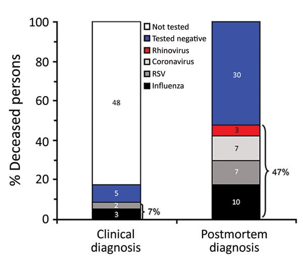 Clinical and postmortem detections of respiratory viruses among 57 deceased persons >65 years of age, Spain, 2017. As indicated, 47% of deceased patients tested positive for respiratory virus infection postmortem, but only 7% had received the same diagnosis before death. Clinical and postmortem detections of respiratory viruses among 57 deceased persons >65 years of age, Spain, 2017. As indicated, 47% of deceased patients tested positive for respiratory virus infection postmortem, but only 7% had received the same diagnosis before death.
