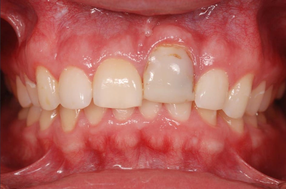 a gross photo of teeth this weird dentist sent me