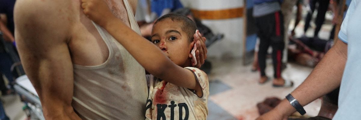 A man carries a child injured in an Israeli attack at Nasser Hospital 
