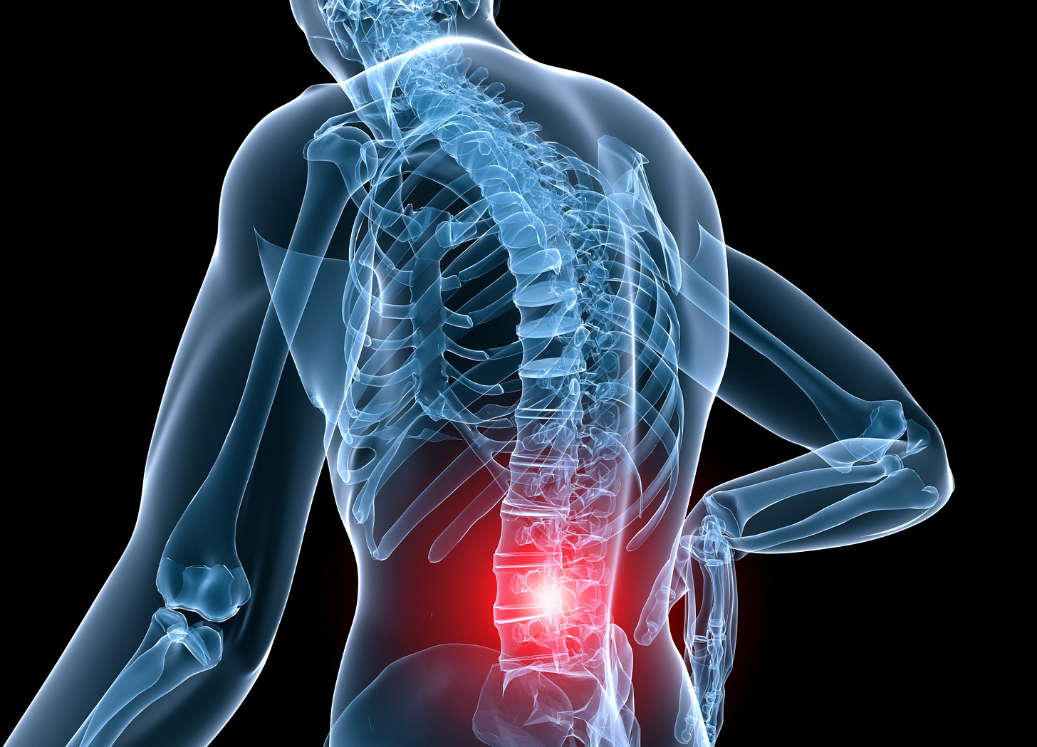 Low Back Pain and/or Nerve Impingement - Structura Body Therapies