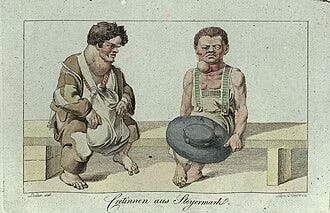 A 1815 print of cretinism in two male subjstcts with goiters A 1815 print of cretinism in two male subjstcts with goiters