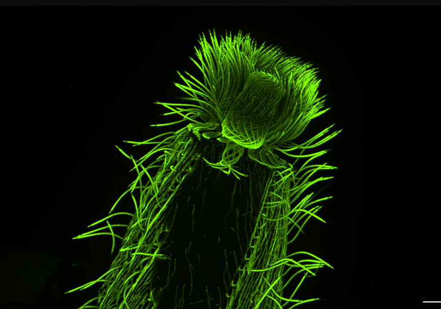 Plancton révélé : la microscopie d’expansion révolutionne l’océanographie Plancton révélé : la microscopie d’expansion révolutionne l’océanographie
