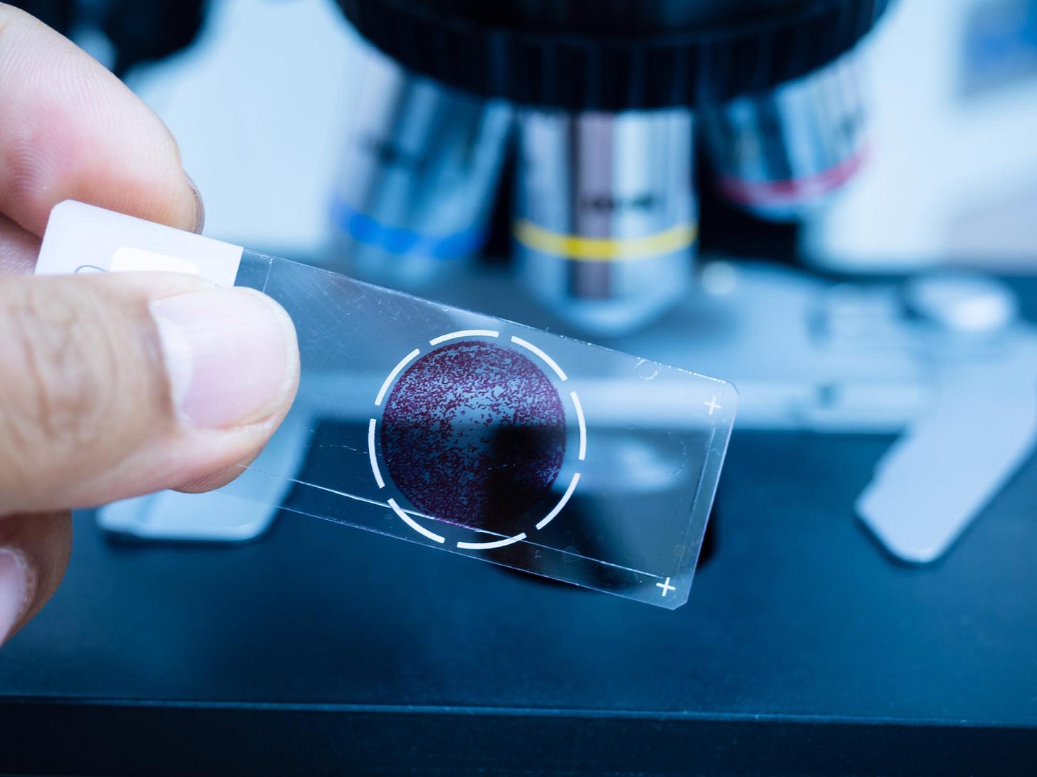 What is Pathology? What is Pathology?