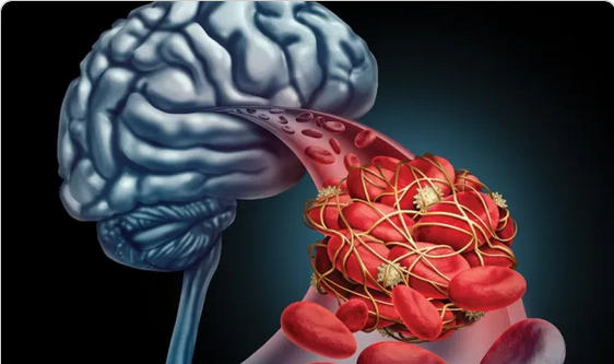 Endotoxins in Pfizer jabs mimic Nickel Allergy
