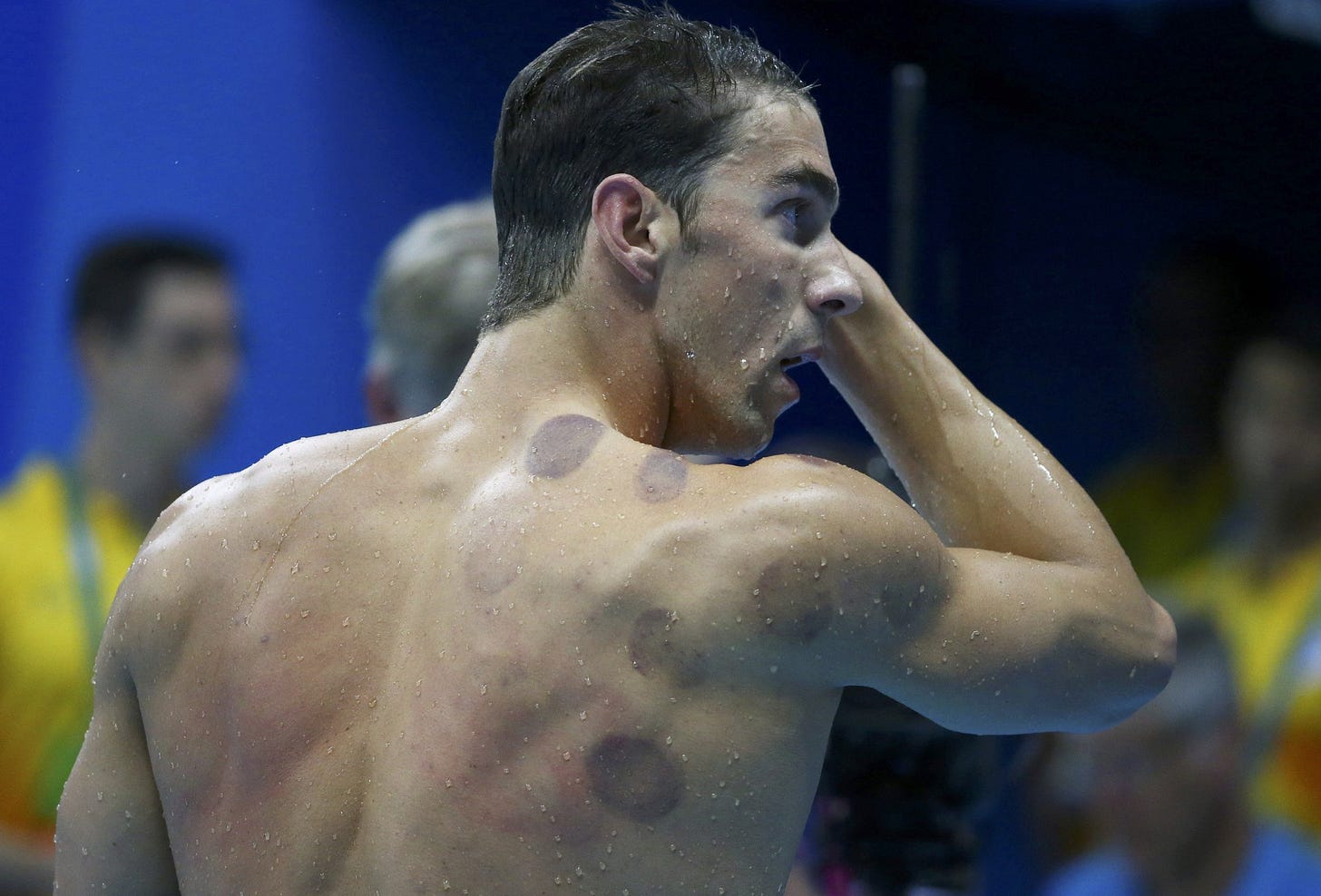 Michael Phelps and the Great Cupping Debate: Why the Olympic Gold Medalist  May Actually Be Right - Newsweek