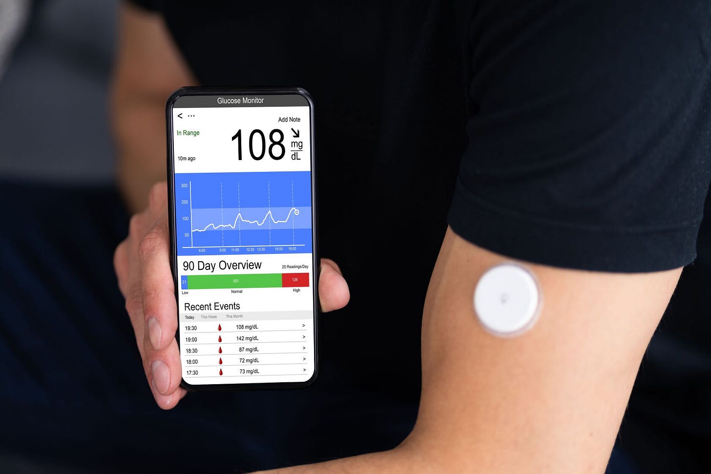 Continuous blood glucose monitors are helpful tracking tool for ...