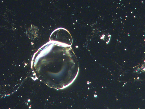 More of the structures that concentrated from blood into the H202