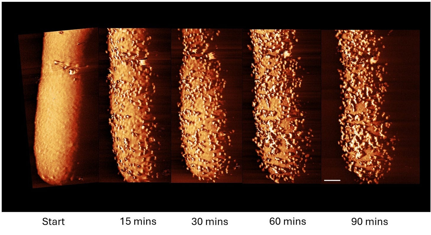 Bacteria response to antibiotics