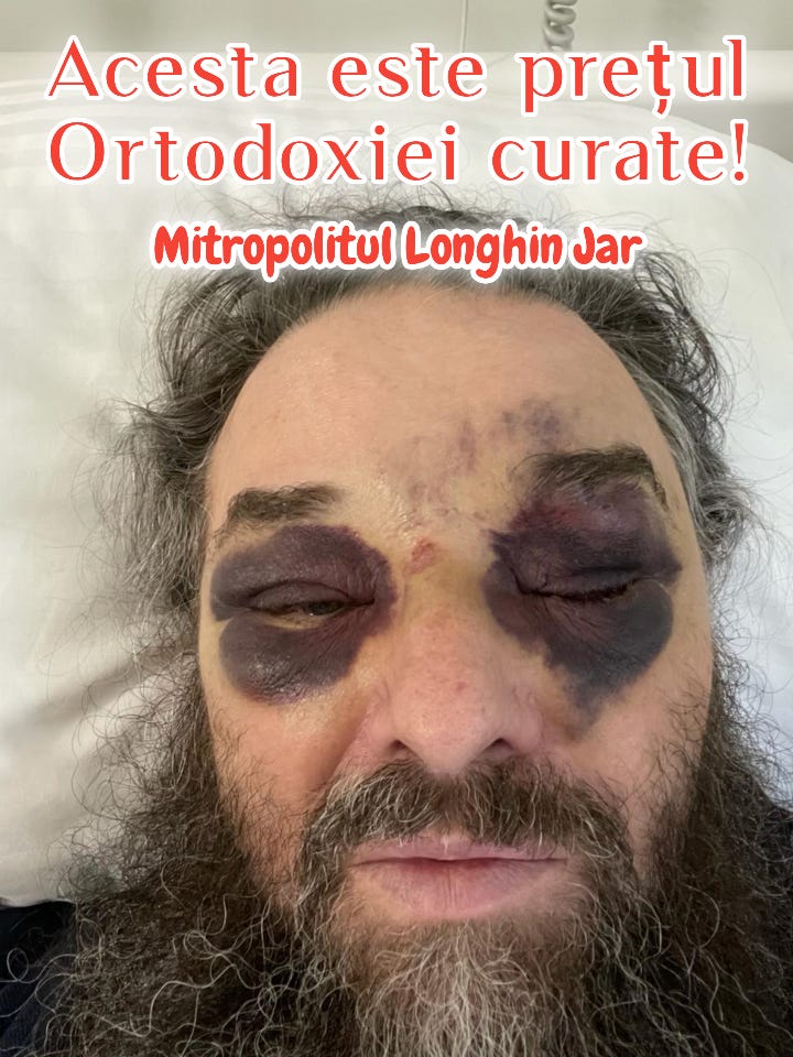 Acesta este prețul Ortodoxiei curate! Mitropolitul Longhin Jar | Запасной канал. Банченский Монастырь Acesta este prețul Ortodoxiei curate! Mitropolitul Longhin Jar | Запасной канал. Банченский Монастырь
