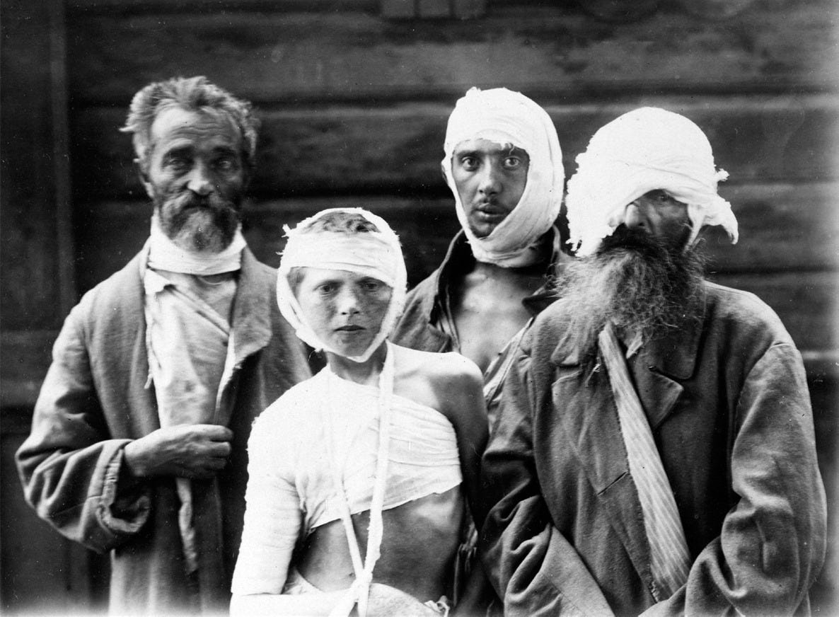 Four males from old to very young, heavily bandaged and wearing ill-fitting coats with no shirts.
