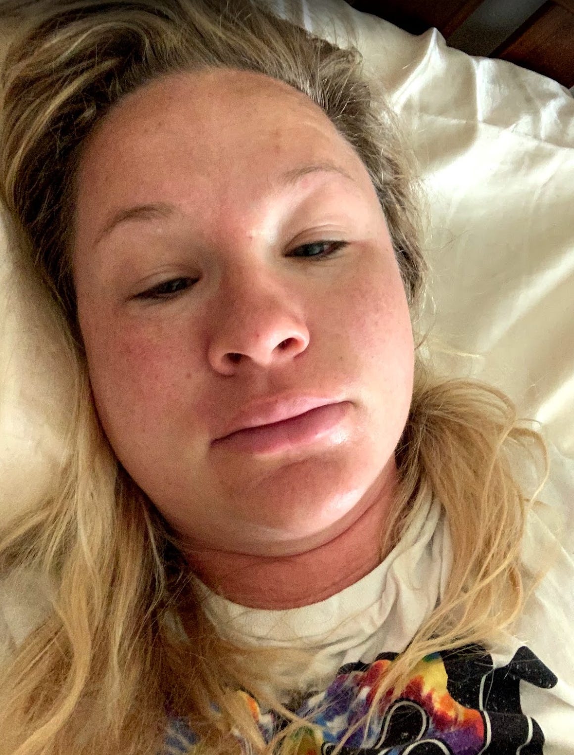 swollen face and hands, preeclampsia symptoms at 30 weeks pregnant swollen face and hands, preeclampsia symptoms at 30 weeks pregnant