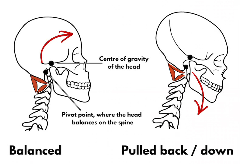 Balanced head and neck versus head pulled back and neck compressed
