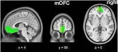 Medial orbitofrontal cortex (mOFC) (right and left, green) and nucleus... |  Download Scientific Diagram